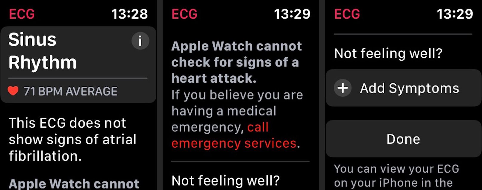 ECG-resultaten van Apple Watch