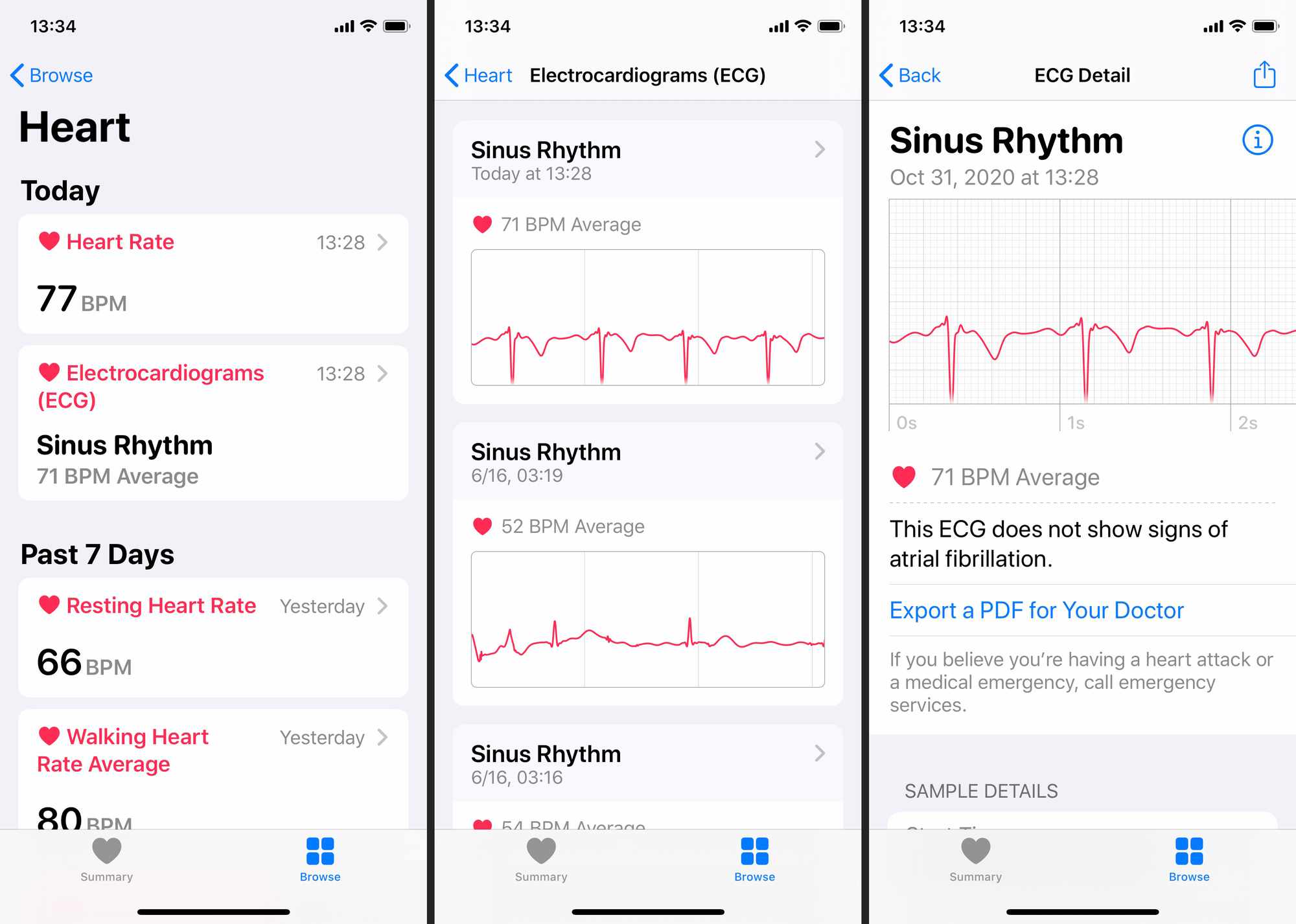 U kunt uw ECG-resultaten ook bekijken in de Gezondheid-app op uw gekoppelde iPhone.