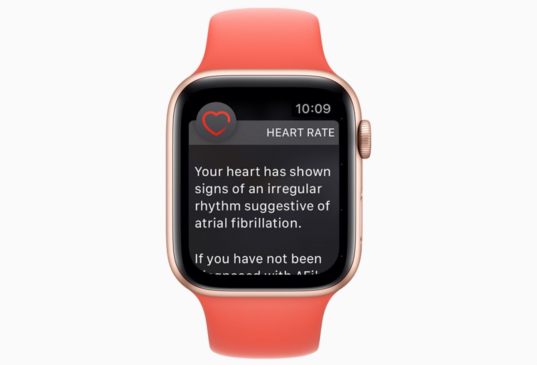 Een Apple Watch met een hartslag AFib-melding